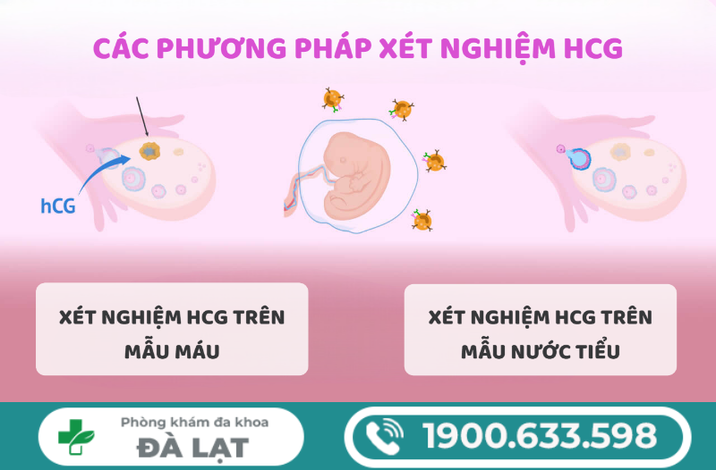 Hình ảnh minh họa